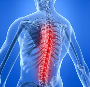 Хронические миогенные болевые синдромы в спине: механизмы развития и подходы к лечению